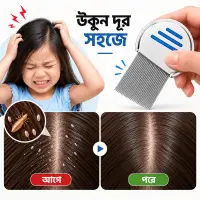 স্টেইনলেস স্টিলের উকুন অপসারণের চিরুনি, Stainless Steel Lice Removal Comb — 2